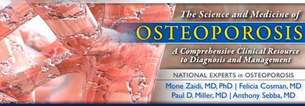 sm of Osteoporosis